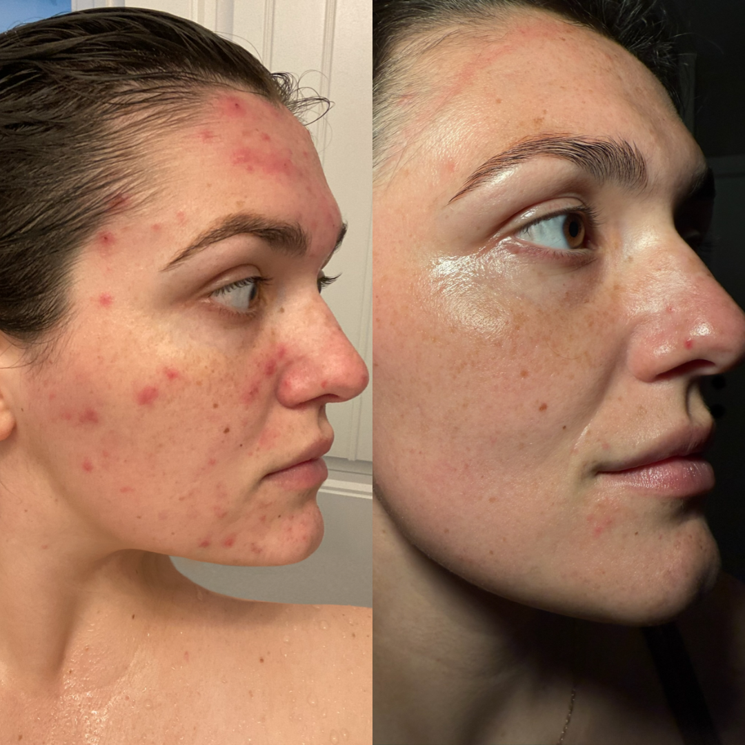 Results after 60 days
