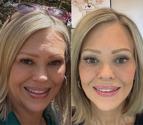 5 Step Skincare Ritual
