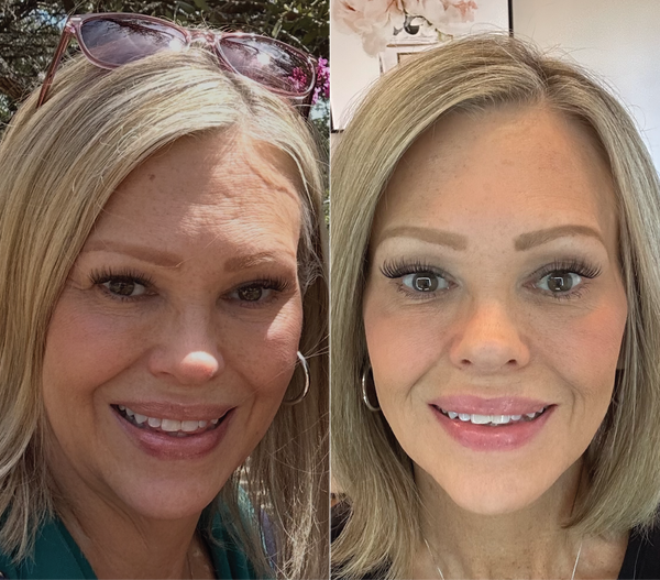 5 Step Skincare Ritual