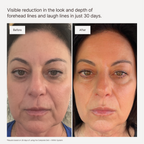 Complete Skincare System