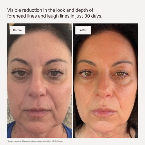 COMPLETE SKINCARE SET