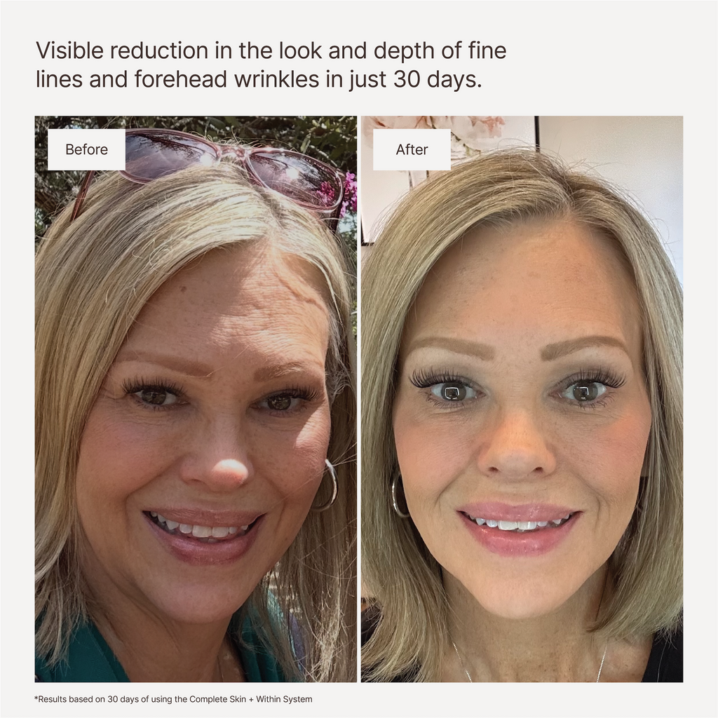 The Brightening System