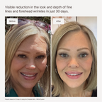 The Brightening System